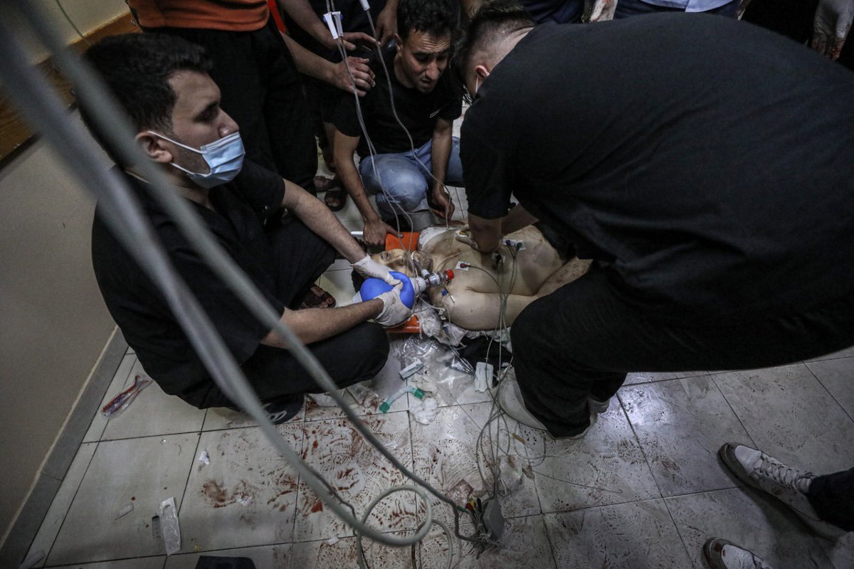 Rasha1788's tweet photo. A Palestinian boy receives medical care at a hospital in the northern Gaza Strip amid a flare-up of Israeli-Palestinian violence
#GazaUnderAttack #GazaUnderAttack #GazaUnderAttack #GazaUnderAttack #GazaUnderAttack #GazaUnderAttack #GazaUnderAttack #GazaUnderAttack https://t.co/WzCKyX1cBD
