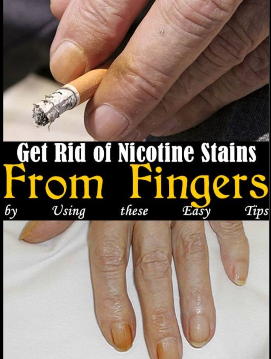 how to get rid of tobacco stained fingers Nicotine stained fingers was a common sight in the 1970's