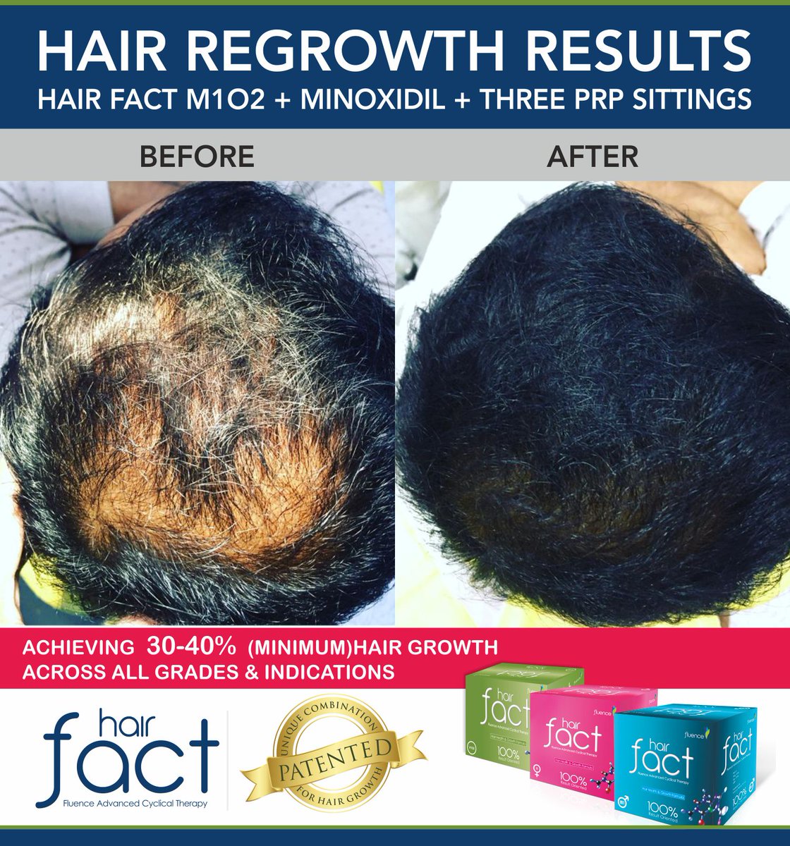 100% Guaranteed Hair Growth | Pro Immune Hair Fact Kit Patented Cyclical  Therapy @DrAbhinitgupta - YouTube