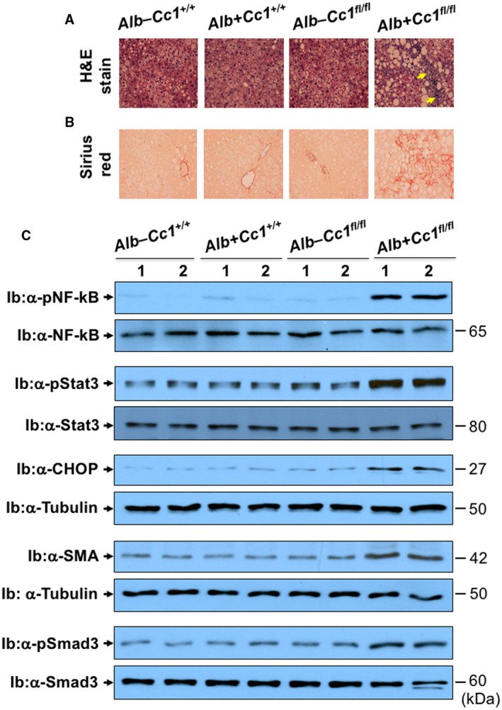 DiabetesLabIBGM's tweet photo. Congratulations to Sonia Najjar! Liver-specific deletion of #CEACAM1 caused metabolic and vascular alterations reminiscent of #NASH and atherosclerosis.
https://t.co/dKn0wPZx4F
#CareLeadsHere
@OUHCOM @DiabetesOhioU https://t.co/xQiW9hiiTz