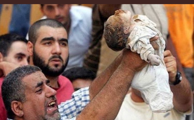 ReyadBelkacem's tweet photo. it isn’t my habit to share this kind of atrocities #GazaUnderAttack #FreePalestine 🇵🇸❤️ https://t.co/N8aGlbBhhR