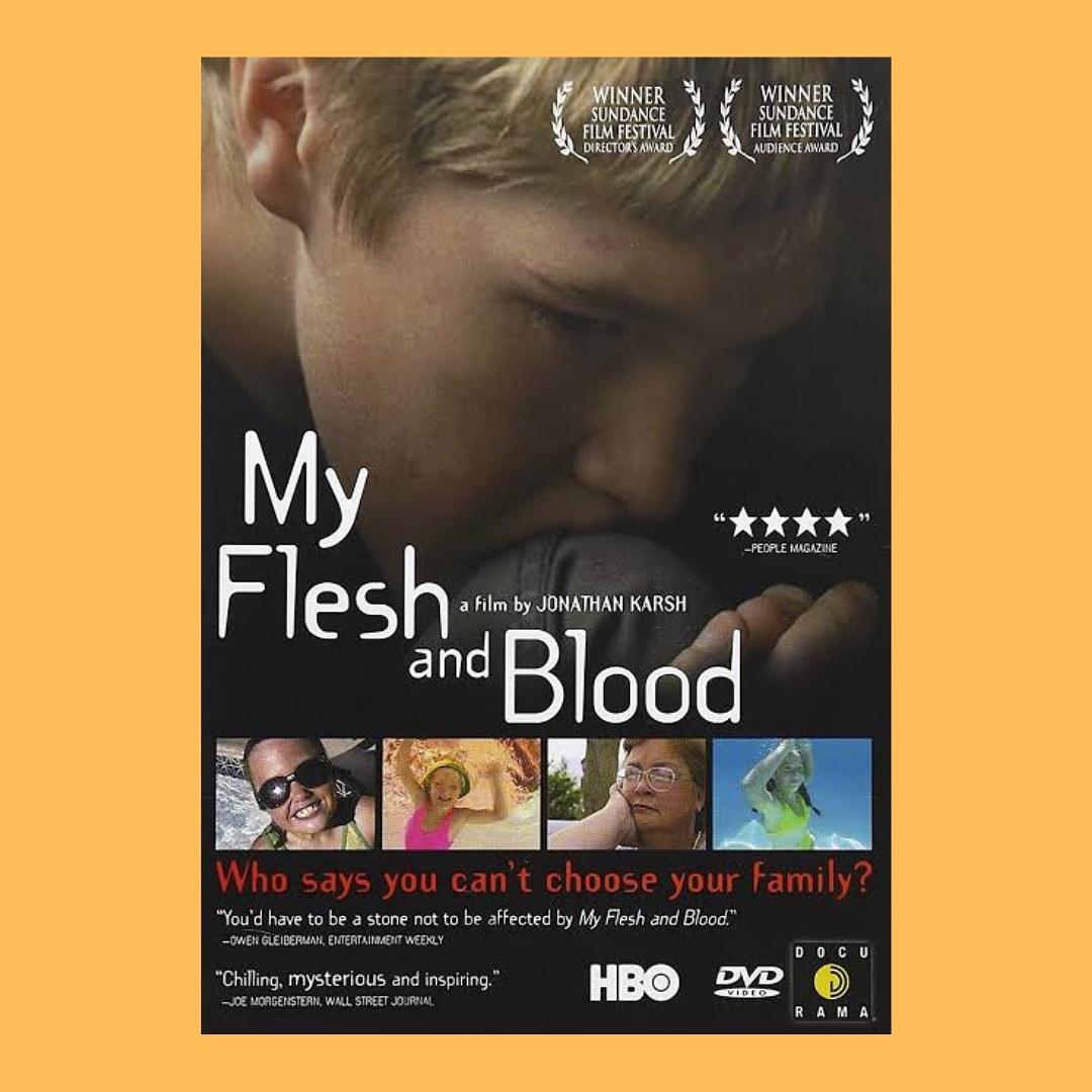 BİRLİKTE İZLİYORUZ 🧡

<a href="/RaDiChallenge/">RaDiChal</a> 
#radichal21 #cysticfibrosis #kistikfibrozis #raredisease #nadirhastalıklar #awareness #CF