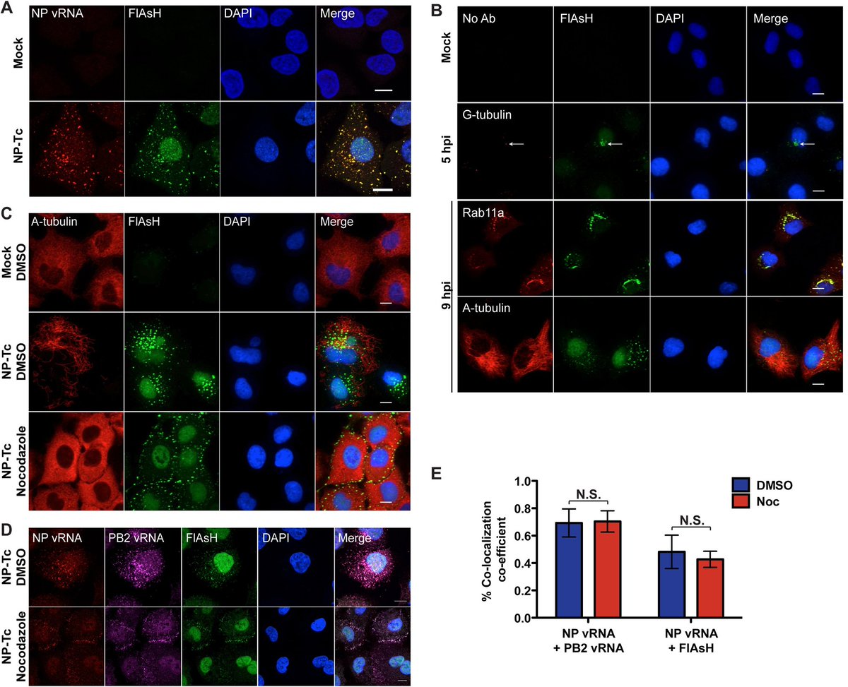 PLOSPathogens's tweet photo. Julianna Han, @ManicassamyLab and colleagues @uiowa @UChicago show that Rab11a+ vesicles serve as platforms for the congregation and assembly of 8 individual viral RNA segments needed to form infectious influenza virus particles.
https://t.co/c9L5BtmtTn https://t.co/GqzygDbfs5