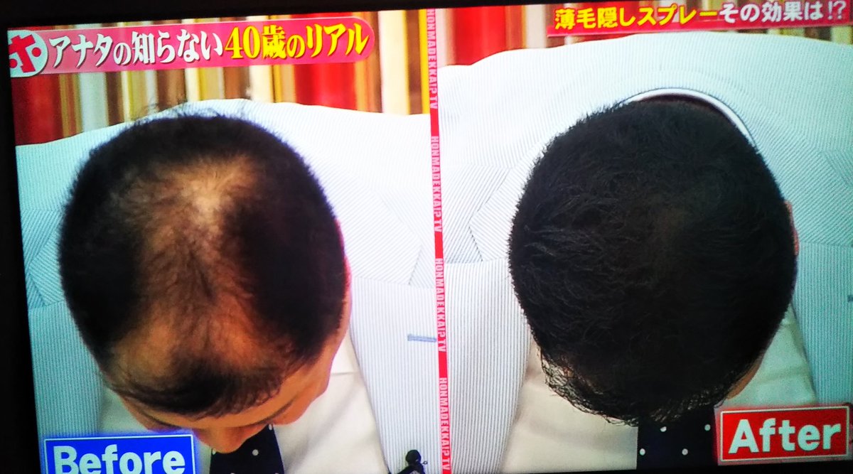 Ryst Cax カックス スプレーすることにより3dファイバーが付着して髪の毛が太くなるらしい 一本で一ヶ月使えるんだとか これは売れそう ホンマでっかtv Ryst Cax カックス スプレーすることにより3dファイバーが付着して髪の毛が太くなるらしい 一本で一ヶ月使えるんだとか これは売れそう ホンマでっかtv