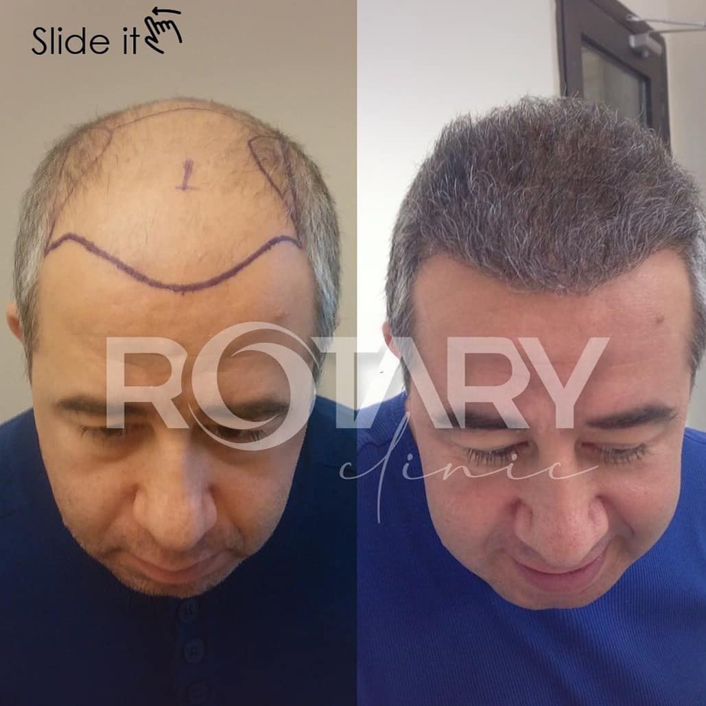 Rotary Clinic on Twitter: Rotary Clinic on Twitter: