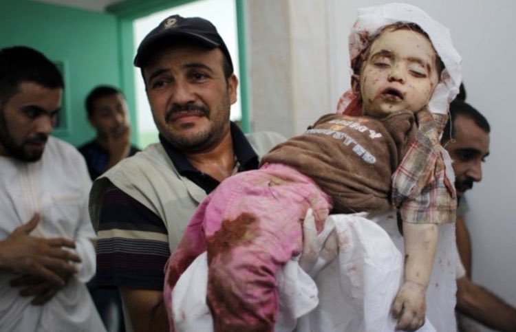 Nadosoo1's tweet photo. Let the world know the difference between Israel and the Palestinian resistance
When the war started.
The Palestinian resistance bombed the military enclaves 
while
Thehit gaza's children
What guilt did the children of Gaza kill?
#GazaUnderAttack 
#IsraeliTerrorism https://t.co/6Qr0sUernl