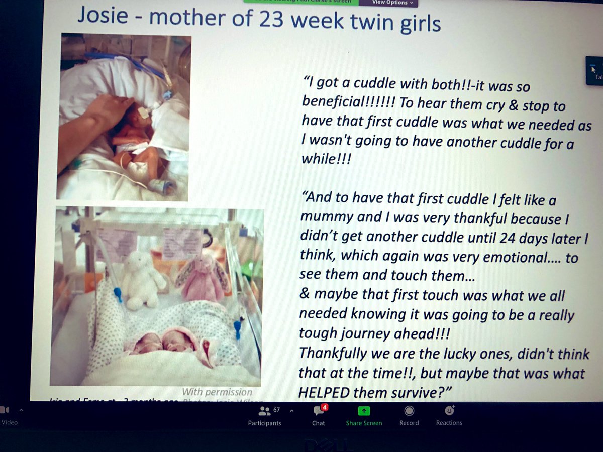 Delivery room cuddles are so important as @LeosNeonatal says “they have the power to change the trajectory of someone’s grief” Amazing video from @Emmaallen1980 and always brilliant to hear @drpaulclarke talk about making #deliveryroomcuddles in #NICU standard practice 💛