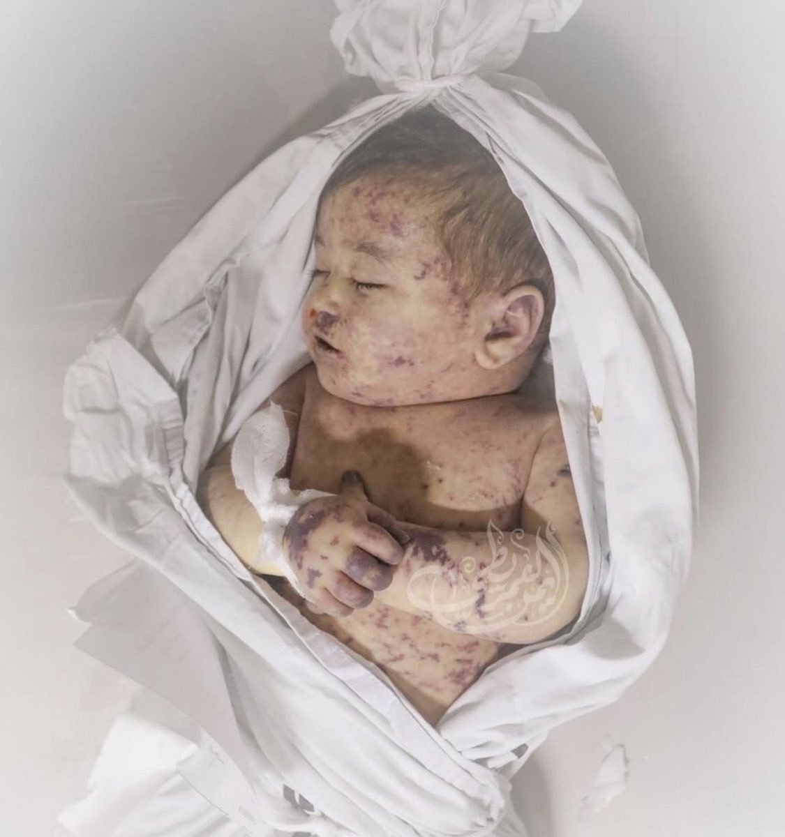 اي جرم هذا 💔 
طير من طيور الجنة 🕊. 

#القدس_تنتفض 
#GazaUnderAttack 
#IsraeliTerrorism