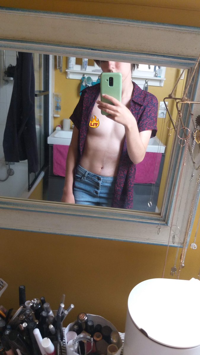 valqueery's tweet image. #NoMammec non binaire transmasc, je ne veux pas faire de transitions médicale.
j’ai eu un rapport compliqué avec mes seins trop petit pour la norme pendant longtemps mais mtn je les aimes énormément, et g absolument pas envie de m’en séparer.