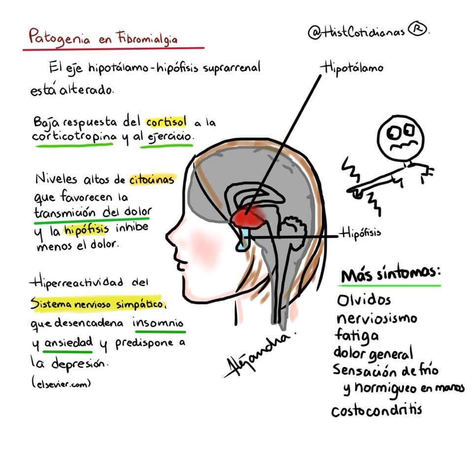 HistCotidianas's tweet photo. Infografías sobre #fibromialgia #DiaDeLaFibromialgia #12deMayo @NoInvisibles @FibroParla https://t.co/sdXXQ0YSG5