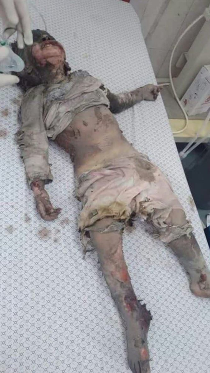 Iranlove17's tweet photo. @Benzema Karim, do something for Palestine for God's sake.  Israel massacres innocent Palestinian children.  Karim, do something for God https://t.co/6DzbV3pL04