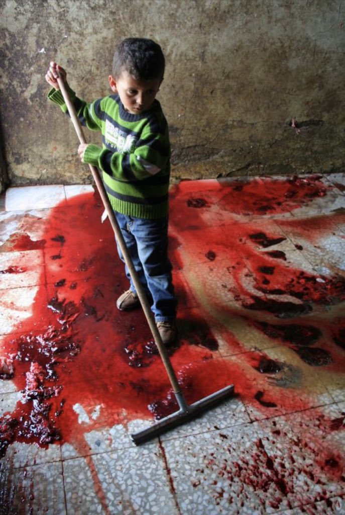 One of the Israeli occupation crimes
#GazaUnderAttack