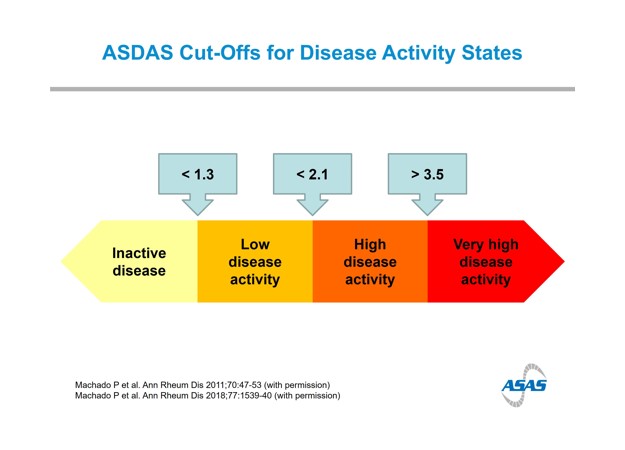 Disease activity state by ASDAS-CRP vs. ASDAS-qCRP (A) and ASDAS-CRP