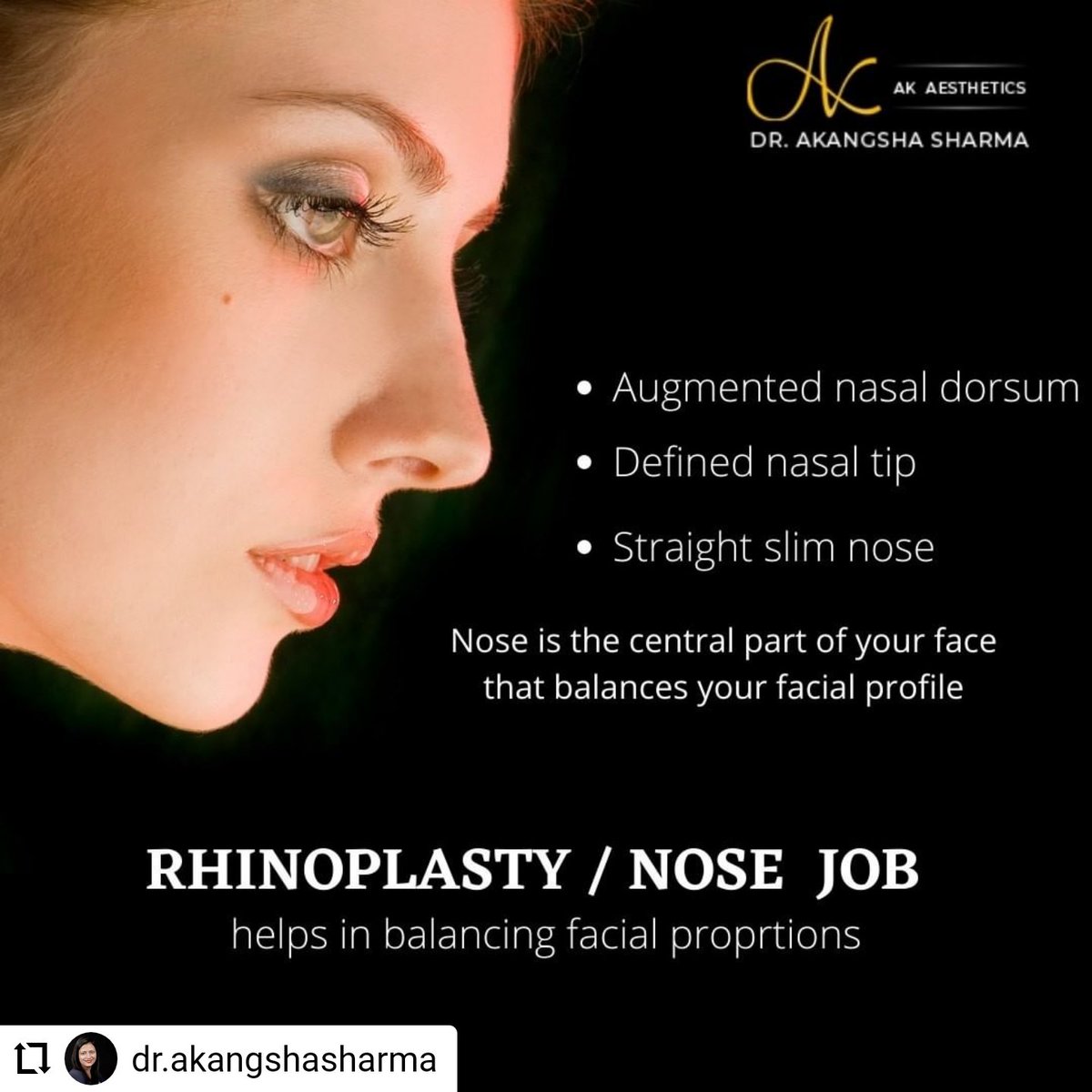 SharmaAkangsha's tweet photo. #Rhinoplasty commonly known as the #nosejob
For queries, get in touch with us at +91 9116630655  https://t.co/VRA9HzFSBj
#nosereshaping #deviatedseptum #crookednose #plasticsurgeoninjaipur #rhinoplastysurgeonjaipur #drakangshasharma #plasticsurgeoninindia https://t.co/YKpDSQwtBa