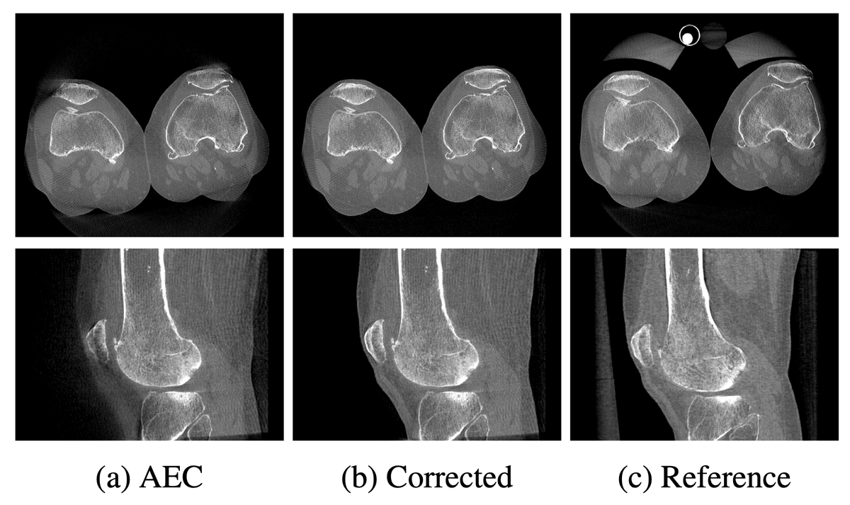 Andreas K. Maier (@maier_ak) on Twitter photo 3D non-rigid alignment of low-dose scans allows to correct for saturation in lower extremity cone-beam CT
ieeexplore.ieee.org/document/94275âŠ
<a href="/SpirosMargaris/">Spiros Margaris</a> <a href="/antgrasso/">Antonio Grasso</a> <a href="/ResearchGermany/">Research in Germany - Initiative of the BMFTR</a> <a href="/DrJDrooghaag/">Dr. ir Johannes Drooghaag (JD) #BYOC! đ</a> <a href="/BVM_Community/">BVM Community</a> <a href="/unifau/">FAU Erlangen-Nbg</a> <a href="/ResearchGermany/">Research in Germany - Initiative of the BMFTR</a> <a href="/DGBMT/">DGBMT</a> <a href="/BVMI_eV/">BVMI eV</a> <a href="/gmdsEV/">GMDS e.V.</a> <a href="/TF_UNI_Erlangen/">Technische FakultĂ€t (TF) der FAU</a> 3D non-rigid alignment of low-dose scans allows to correct for saturation in lower extremity cone-beam CT
ieeexplore.ieee.org/document/94275âŠ
<a href="/SpirosMargaris/">Spiros Margaris</a> <a href="/antgrasso/">Antonio Grasso</a> <a href="/ResearchGermany/">Research in Germany - Initiative of the BMFTR</a> <a href="/DrJDrooghaag/">Dr. ir Johannes Drooghaag (JD) #BYOC! đ</a> <a href="/BVM_Community/">BVM Community</a> <a href="/unifau/">FAU Erlangen-Nbg</a> <a href="/ResearchGermany/">Research in Germany - Initiative of the BMFTR</a> <a href="/DGBMT/">DGBMT</a> <a href="/BVMI_eV/">BVMI eV</a> <a href="/gmdsEV/">GMDS e.V.</a> <a href="/TF_UNI_Erlangen/">Technische FakultĂ€t (TF) der FAU</a>