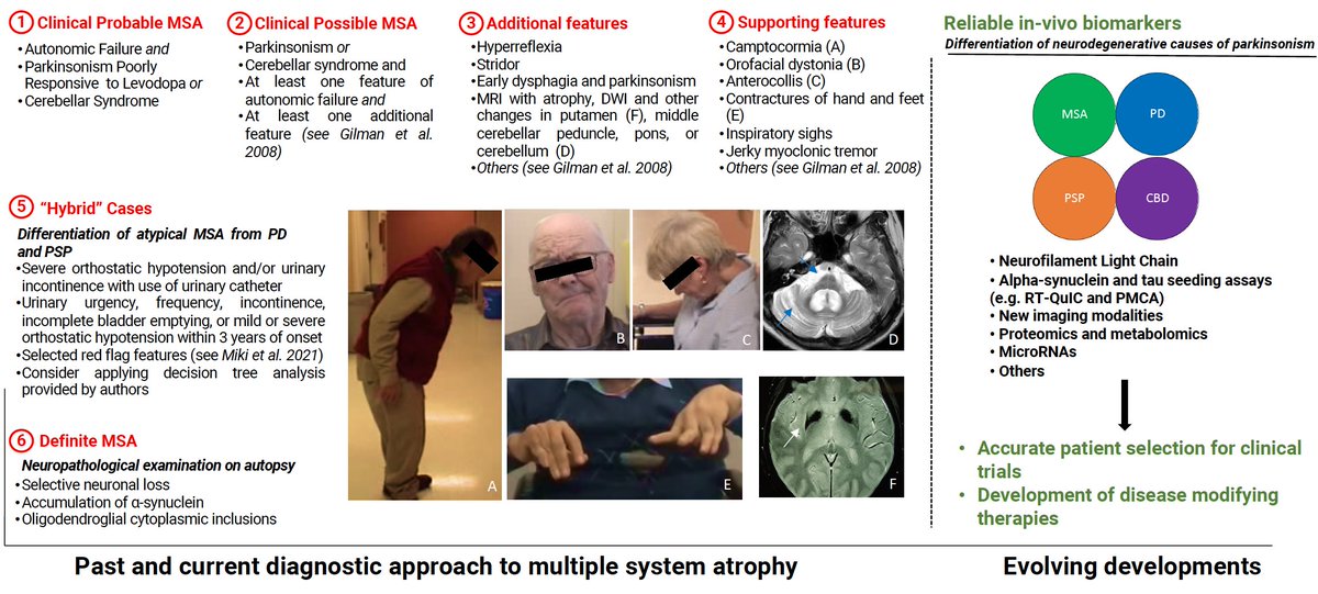 Is clinical assessment enough? Moving towards early differentiation of neurodegenerative parkinsonisms. New commentary by Daniel G Di Luca and Anthony E Lang bit.ly/2SC5MNd