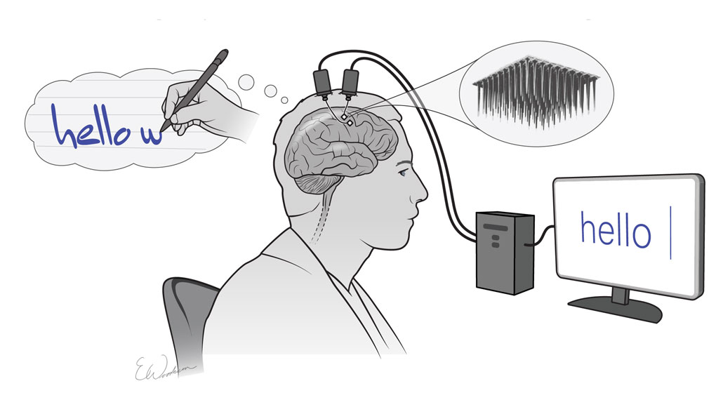 ScienceNews's tweet photo. Brain-to-text technology could help people with paralysis communicate.
 https://t.co/Mm0vZCrxwR https://t.co/cUWqwHk8KI