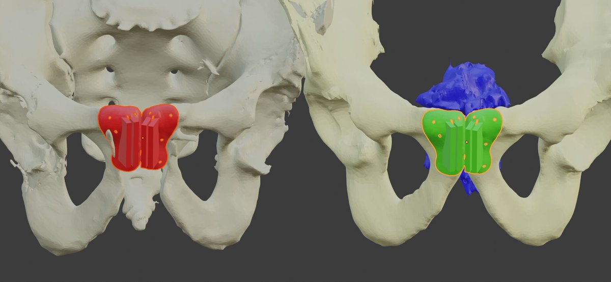 $MTLS #EXPERT3D based out of Europe. Vast opportunities for 3D printing and #AI in different spaces within medicine. 

vimeo.com/511632893/e784…