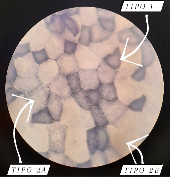 sFernandez26_'s tweet photo. 1º Corte transversal de músculo esquelético teñido con hematoxilina-eosina
2º Corte transversal de músculo esquelético con tinción NADH-TR
3º Corte transversal de médula espinal con tinción de Nissl
@HistologiaC #histomed141 https://t.co/Nt4bqP26Ch