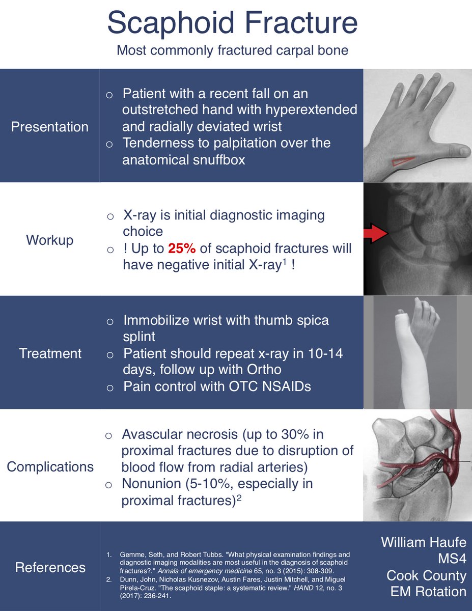 CookCountyEM's tweet photo. Snuffbox tenderness? A quick infographic created by one of our now PGY-1s Dr. William Haufe. Check it out on our blog #CountyConsult link 👇

https://t.co/0iJxpS206t https://t.co/3vmdgxpD4k
