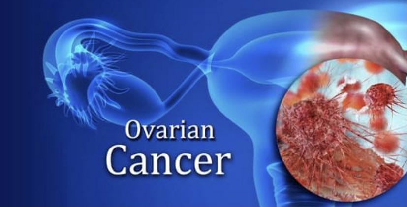 Ladies join us next Tuesday night for an insight into Ovarian Cancer. Ladies post menopause are particularly vulnerable so join us to learn about the signs and symptoms- this 45 minute talk could save your life! 

Tuesday 18th May at 7.30 pm via Zoom 
code 485 8349 165