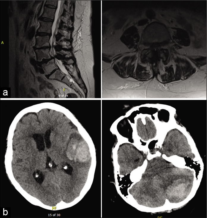 Surgical Neurology International (SNI) tweet media