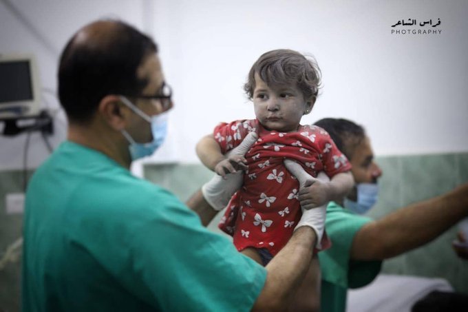 Timesofgaza's tweet image. Painful pictures of wounded children, after targeting their house today in Rafah - Southern Gaza Strip.

#GazaUnderAttack