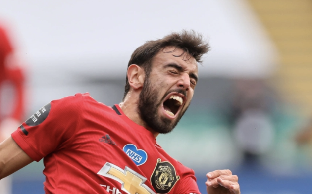 A fly lands on Bruno Fernandes' arm.

Bruno: