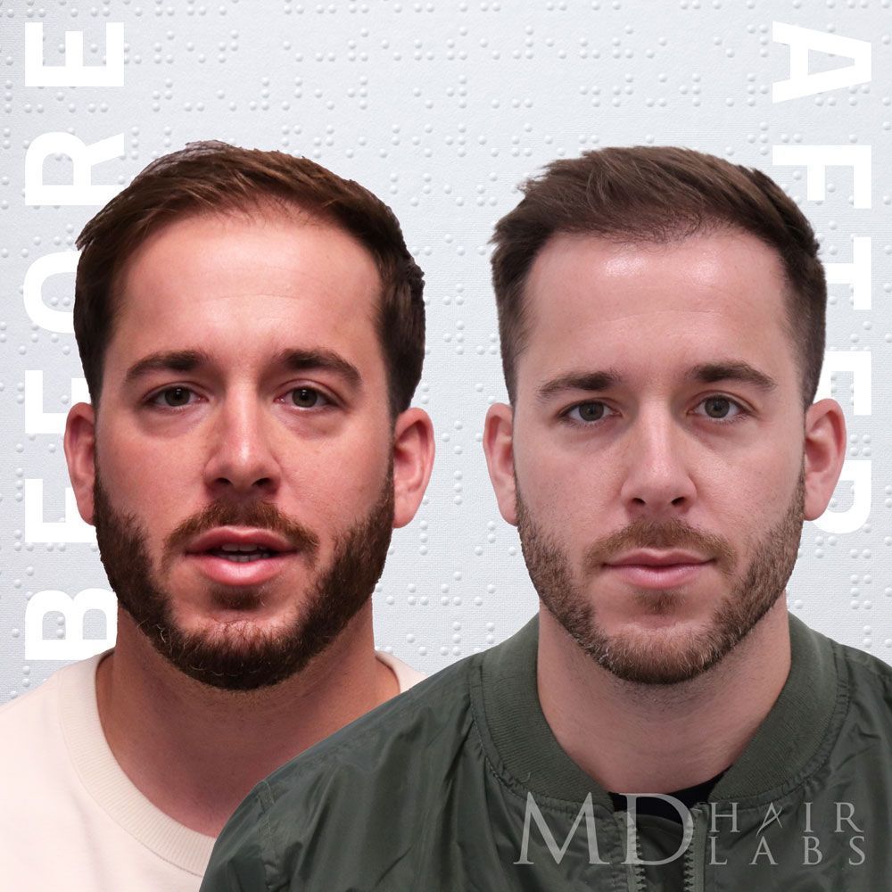 md hair reviews
