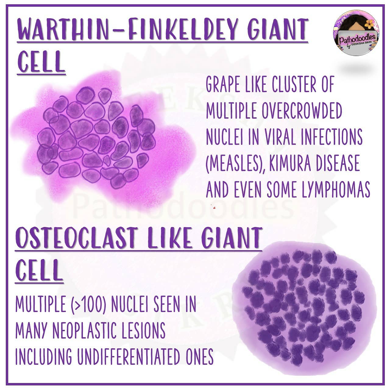 Pathodoodles By Deeksha Sikri On Twitter Same Multinucleated Giant Cells Pathtwitter Pathodoodles Meded Pathart Medstudenttwitter Surgpath Https T Co Uvvjgiipni Twitter