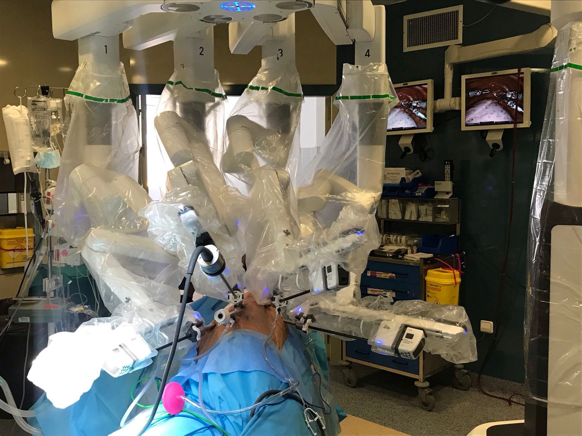 aiblancoo's tweet photo. Después de 8 años que iniciamos el programa de timectomías robóticas, hoy hemos iniciado una nueva andadura con las lobectomías pulmonares robóticas. Gracias a todos los que lo han hecho posible @HospitalUVRocio @CirToracicaHUVR, @abexDaVinci, Dr.Moradiellos y a todo el personal. https://t.co/37zN62b67Q