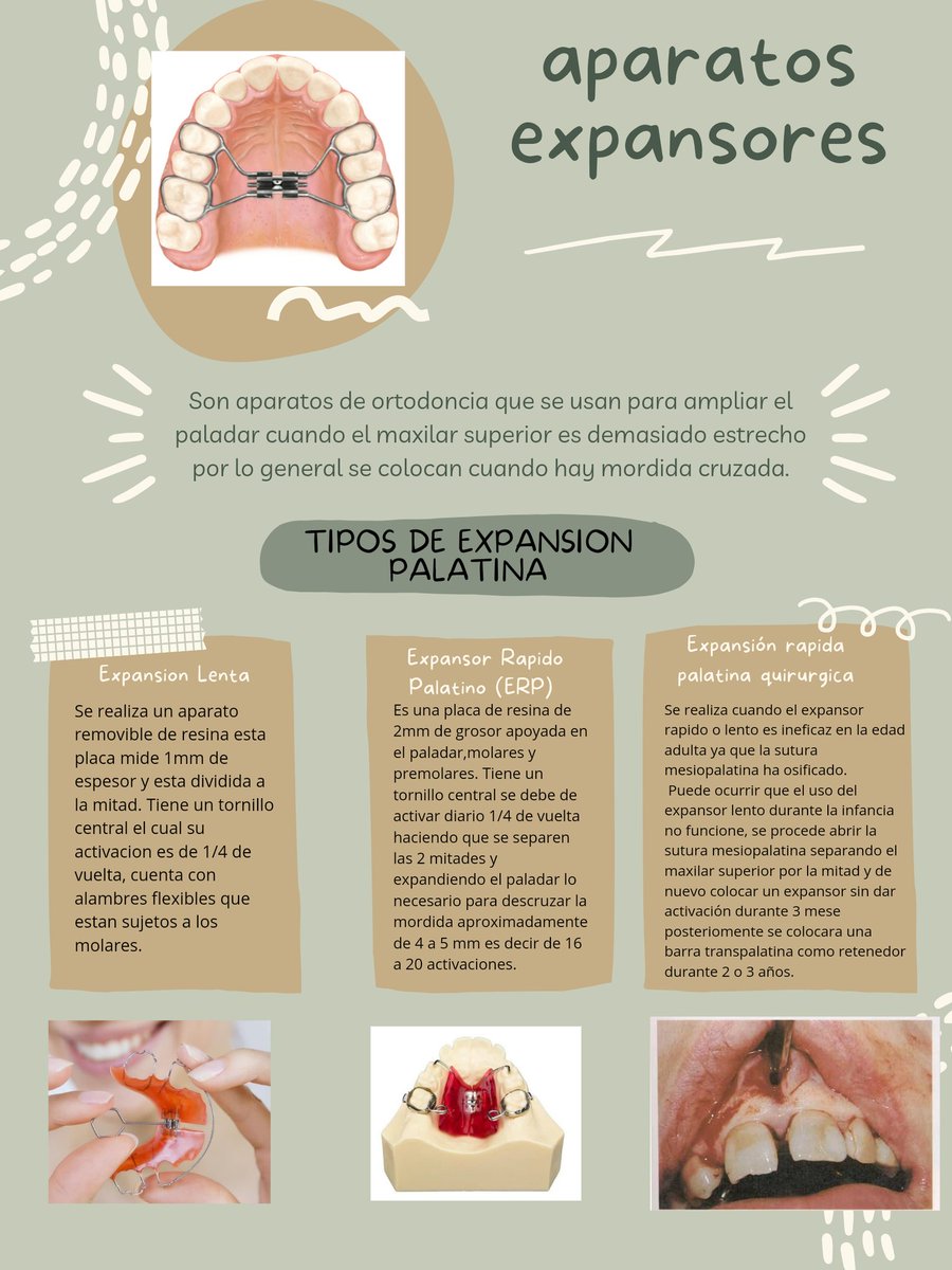 MariaFe44191922's tweet photo. APARATOS ORTOPEDICOS EXPANSORES DEL PALADAR https://t.co/ZBFfRd2lRm