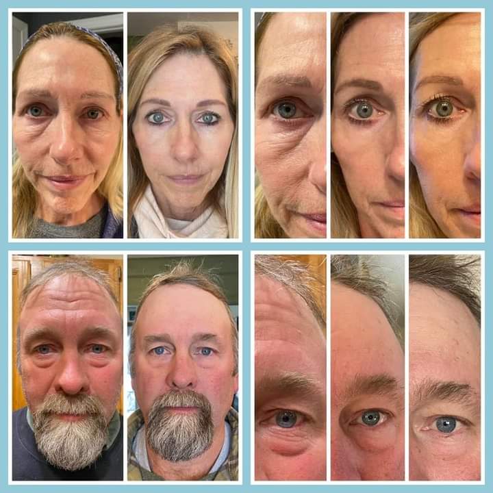 saintdusty's tweet photo. Hi #nwaleshour #shrewsburyhour
Collagen elixir will soon be available in the UK & Europe.
The results from the States & the land downunder are remarkable.
200 scientists & 10 years in the making :)
#ageinginreverse
#botoxinabottle https://t.co/TXmTteLJQc
