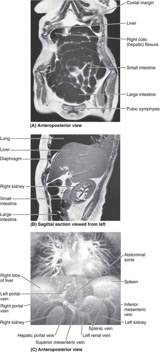 SECTIONAL MEDICAL IMAGING OF ABDOMEN. #SoMe4IQLatAm #SoMe4Surgery #MedTwitter