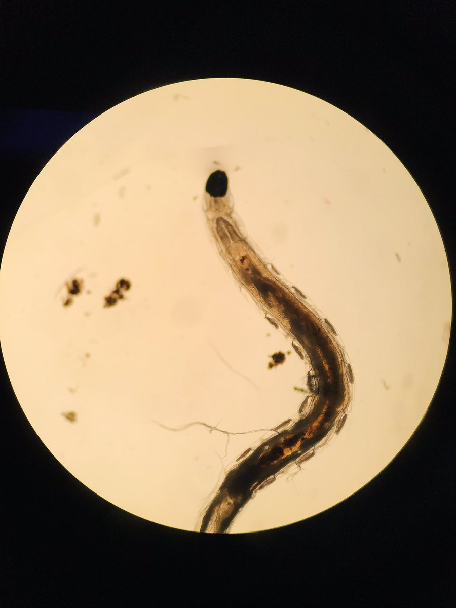VHNguyenMD's tweet photo. I put a dome over my propagation and thi little guy came out and play on one of the leaves πͺ±π- some kind of earth worms or parasites? Too big for #Tardigrades
Do I see lung π«? #grossognosis
#pathcritter #plantmedtwitter @tardigradopedia @ParasiteGal @Histopatolomon https://t.co/CsTFKAEpg7