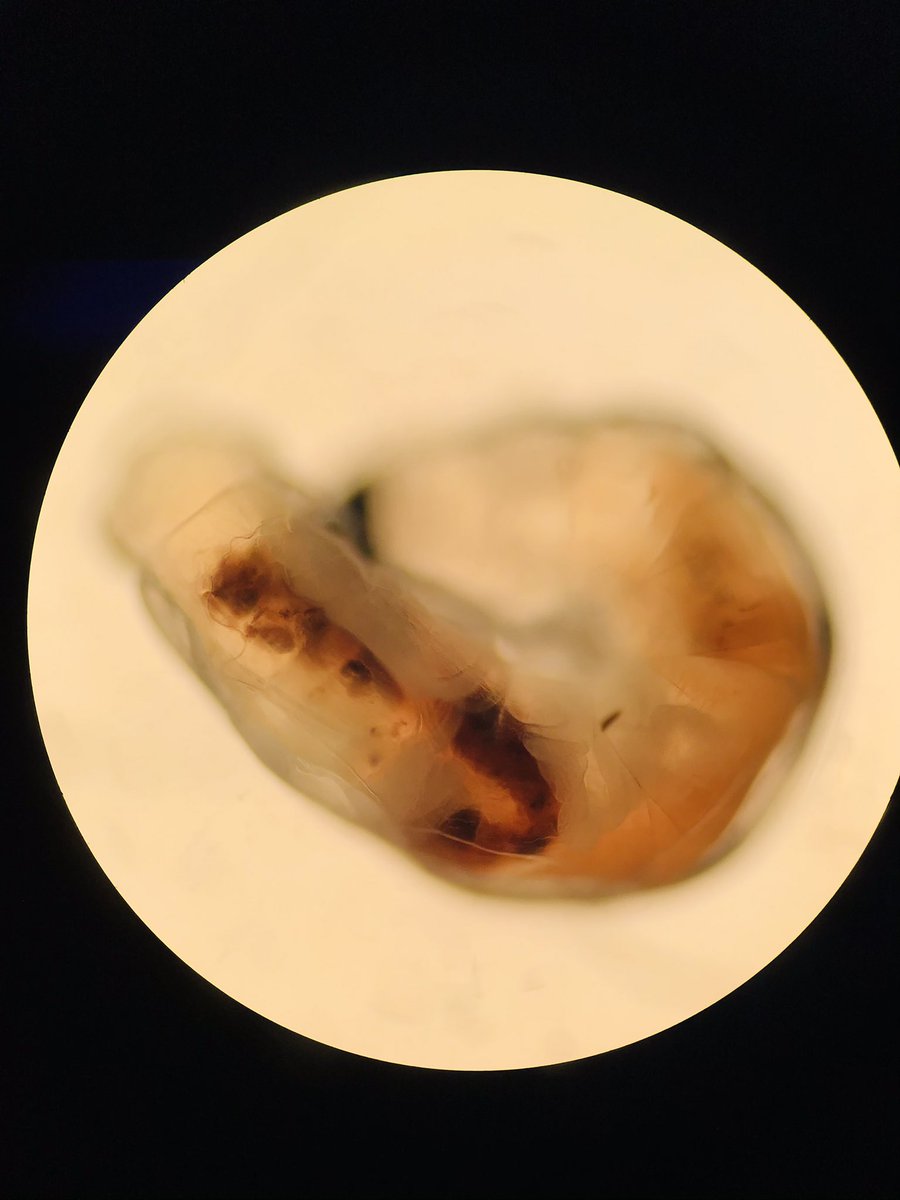 VHNguyenMD's tweet photo. I put a dome over my propagation and thi little guy came out and play on one of the leaves πͺ±π- some kind of earth worms or parasites? Too big for #Tardigrades
Do I see lung π«? #grossognosis
#pathcritter #plantmedtwitter @tardigradopedia @ParasiteGal @Histopatolomon https://t.co/CsTFKAEpg7