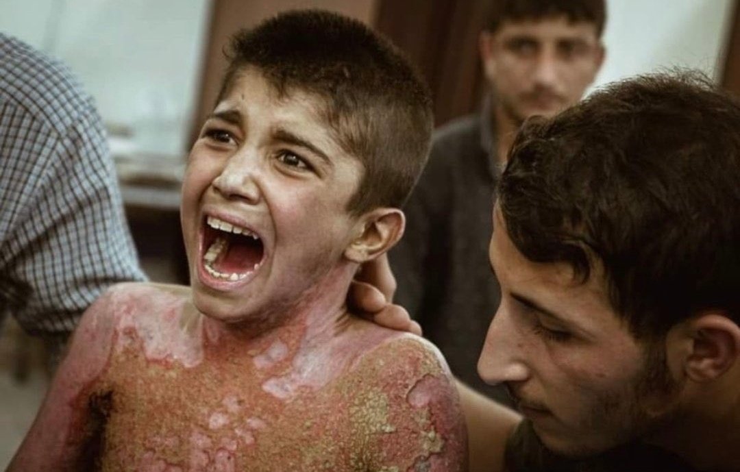 TahirSimsek's tweet photo. SESİMİZİ DUYAN YOK MU!

EY SATILMIŞ MÜSLÜMAN LİDERLER!

#GAZZEDESOYKIRIMVAR https://t.co/vKdHcx1MWt