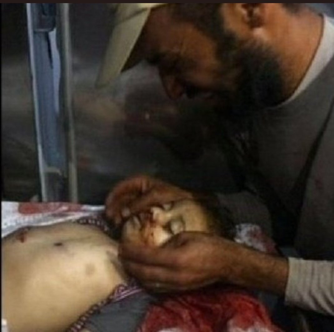 emre57833883's tweet photo. Dünyada
İnsanlık ölüyor
Merhamet ölüyor.
Vicdanlar yok oluyor.
Cocuk bunlar yaa cocuk. 
#GenocideinGaza https://t.co/voRZOclAa6