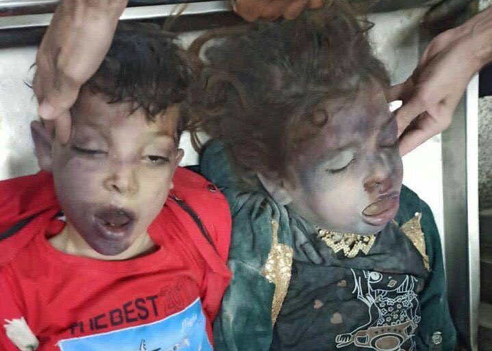 Don't turn your face away, look Baby-killer Israel
#GenocideinGaza 
#GazaUnderAttack 
#TerroristIsrael