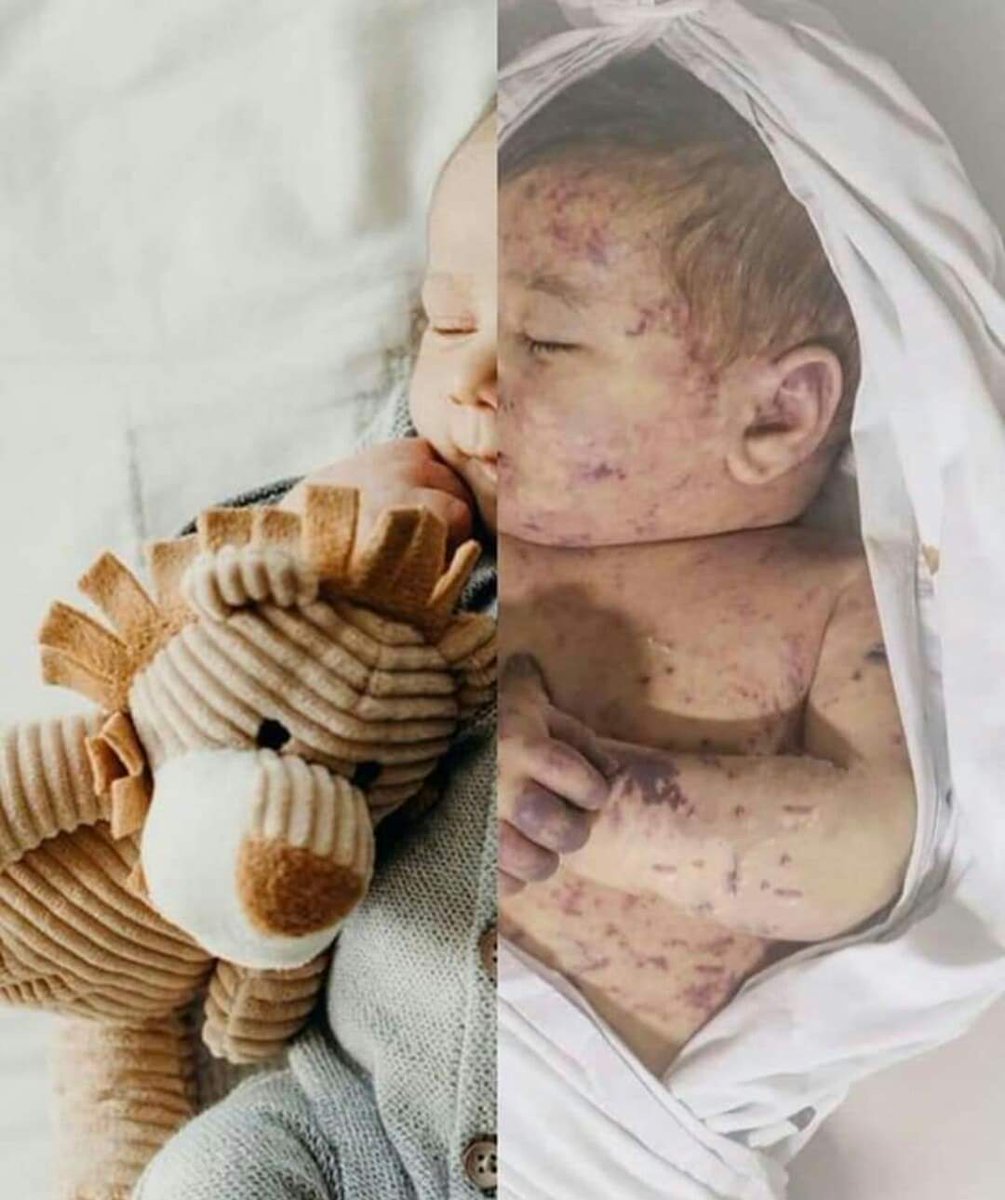 اسرائـ.يل بتستخدم قذائف الفسفور وهي اسلحة محرمة عالمية
ادخلوا فعلوا الهاشتاج على تويتر وافضحوهم 
#Israel_uses_phosphorus_bombs

🇵🇸 #انقذوا_حي_الشيخ_جراح
🇬🇧 #Save_SheikhJarrah_neighborhood
🇺🇸 #savesheikhjarrah 
🇷🇺 #Спасти_район_ШейхДжарра