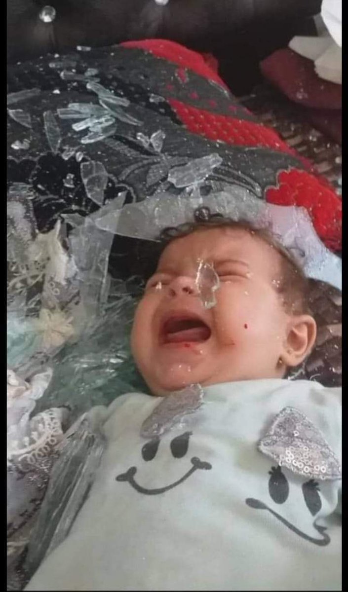 اسرائـ.يل بتستخدم قذائف الفسفور وهي اسلحة محرمة عالمية
ادخلوا فعلوا الهاشتاج على تويتر وافضحوهم 
#Israel_uses_phosphorus_bombs

🇵🇸 #انقذوا_حي_الشيخ_جراح
🇬🇧 #Save_SheikhJarrah_neighborhood
🇺🇸 #savesheikhjarrah 
🇷🇺 #Спасти_район_ШейхДжарра 
🇹🇷 #ŞeyhJarrah_mahallesini_kurtar