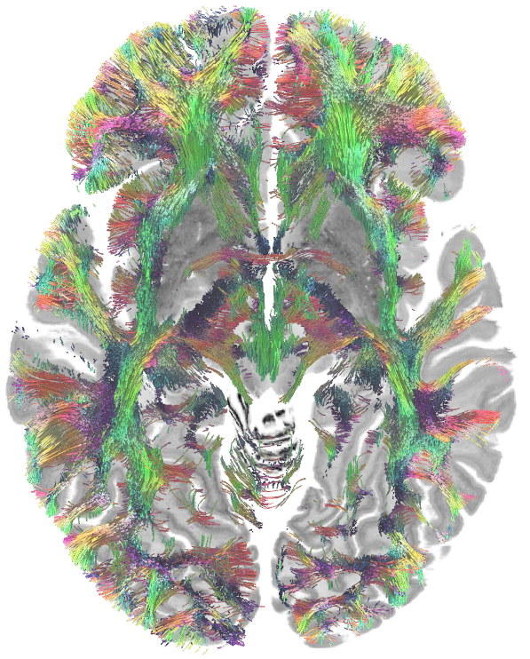 FangChengYeh's tweet photo. Amazing 760-micron DWI data by Wang et. al (Scientific Data. 2021 Apr 29;8(1):1-2.) @MGHMartinos 

I reconstructed 26GB DWI data (QSDR) to ICBM152 space and aligned high-resolution tractography with BigBrain. 

DSI Studio ready-to-track FIB file at https://t.co/nnQF1Mszf3 https://t.co/ltF46EQkSS