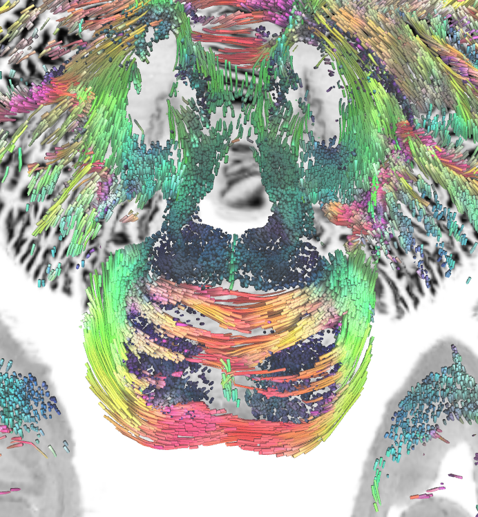 FangChengYeh's tweet photo. Amazing 760-micron DWI data by Wang et. al (Scientific Data. 2021 Apr 29;8(1):1-2.) @MGHMartinos 

I reconstructed 26GB DWI data (QSDR) to ICBM152 space and aligned high-resolution tractography with BigBrain. 

DSI Studio ready-to-track FIB file at https://t.co/nnQF1Mszf3 https://t.co/ltF46EQkSS