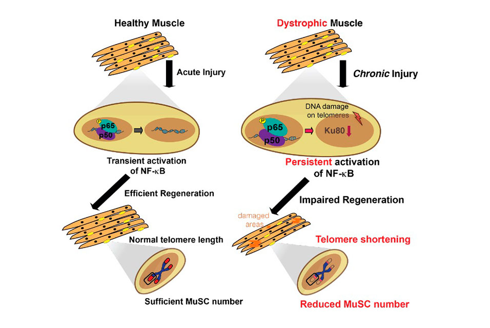 Pathway behind muscle breakdowns in Duchenne muscular dystrophy discovered #pathway #muscle #Duchenne #musculardystrophy #science #newspaper Read more about this here: ow.ly/u5Bt50EM5if