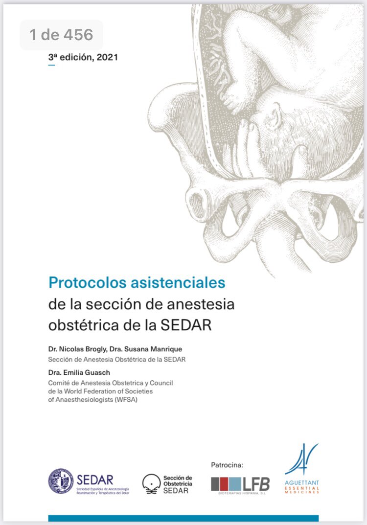 educallecruz's tweet image. El límite de 70-80.000 plaquetas coincide con el propuesto en los protocolos asistenciales de la #anestesiaobstetrica de la @sedar_es . Fundamental tener conceptos claros para estos casos! Gracias!