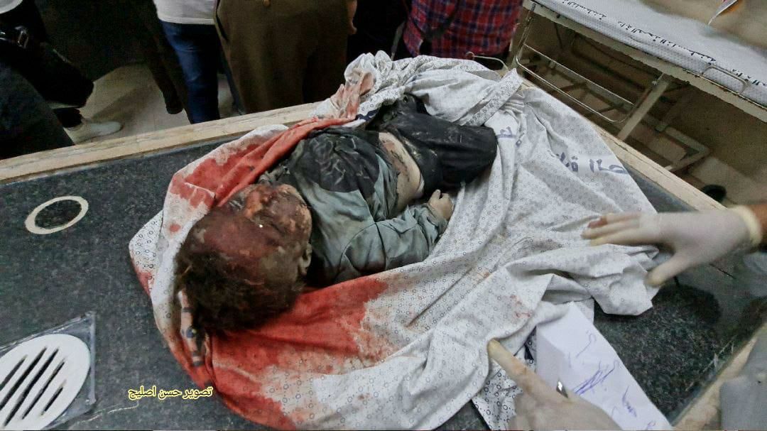LubnaAlmasri3's tweet photo. Medical and human rights sources confirm: The Israeli occupation used toxic gases in Gaza

 #GazaUnderAttack #GazaUnderAttack https://t.co/N7xE0hkTIu