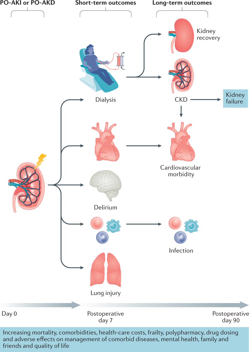 Nature Reviews Nephrology (@natrevneph) on Twitter photo New online! Postoperative acute kidney injury in adult non-cardiac surgery: joint consensus report of the Acute Disease Quality Initiative and PeriOperative Quality Initiative go.nature.com/2RjAv1d <a href="/PeriOpQI/">POQI</a> <a href="/JohnProwle/">John Prowle</a> <a href="/croncoIRRIV/">Claudio Ronco</a> <a href="/montymythen/">montymythen</a> <a href="/kellumja/">John Kellum</a> <a href="/AzraBihorac/">Azra Bihorac</a> <a href="/CCCNPitt/">Crit Care Nephrology</a> New online! Postoperative acute kidney injury in adult non-cardiac surgery: joint consensus report of the Acute Disease Quality Initiative and PeriOperative Quality Initiative go.nature.com/2RjAv1d <a href="/PeriOpQI/">POQI</a> <a href="/JohnProwle/">John Prowle</a> <a href="/croncoIRRIV/">Claudio Ronco</a> <a href="/montymythen/">montymythen</a> <a href="/kellumja/">John Kellum</a> <a href="/AzraBihorac/">Azra Bihorac</a> <a href="/CCCNPitt/">Crit Care Nephrology</a>