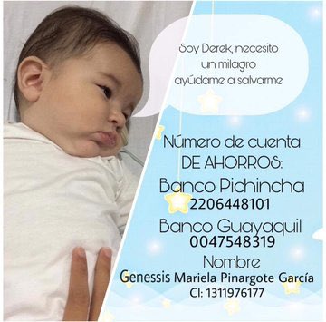 IsmaelUlloaEc's tweet image. 🔴 ¡VAMOS A SALVARLE LA VIDA AL BEBÉ! 

$1 ayuda, si se puede más, mejor aún; somos 17 millones de ecuatorianos, y #UnMilagroParaDerek solo necesita de 2 millones de ecuatorianos.

✅ Más y más RT por favor.