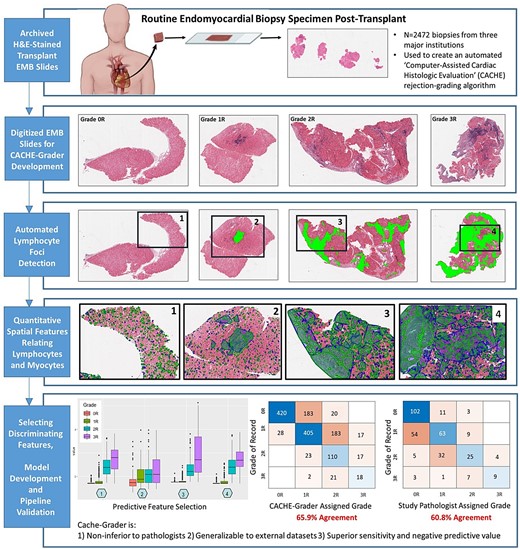 AID2B at CWRU (@aid2b_cwru) on Twitter photo A new CCIPD paper, An Automated Computational Image Analysis Pipeline for Histological Grading of Cardiac Allograft Rejection, was just published in European Heart Journal (<a href="/escardio/">European Society of Cardiology</a> <a href="/OUPAcademic/">Oxford Academic</a> <a href="/ESC_Journals/">European Society of Cardiology Journals</a>). Congrats to all authors! <a href="/SaraYarM1/">Sara A. Yarmohammadi</a> <a href="/anantm/">Anant Madabhushi</a> bit.ly/2SL1za1 A new CCIPD paper, An Automated Computational Image Analysis Pipeline for Histological Grading of Cardiac Allograft Rejection, was just published in European Heart Journal (<a href="/escardio/">European Society of Cardiology</a> <a href="/OUPAcademic/">Oxford Academic</a> <a href="/ESC_Journals/">European Society of Cardiology Journals</a>). Congrats to all authors! <a href="/SaraYarM1/">Sara A. Yarmohammadi</a> <a href="/anantm/">Anant Madabhushi</a> bit.ly/2SL1za1