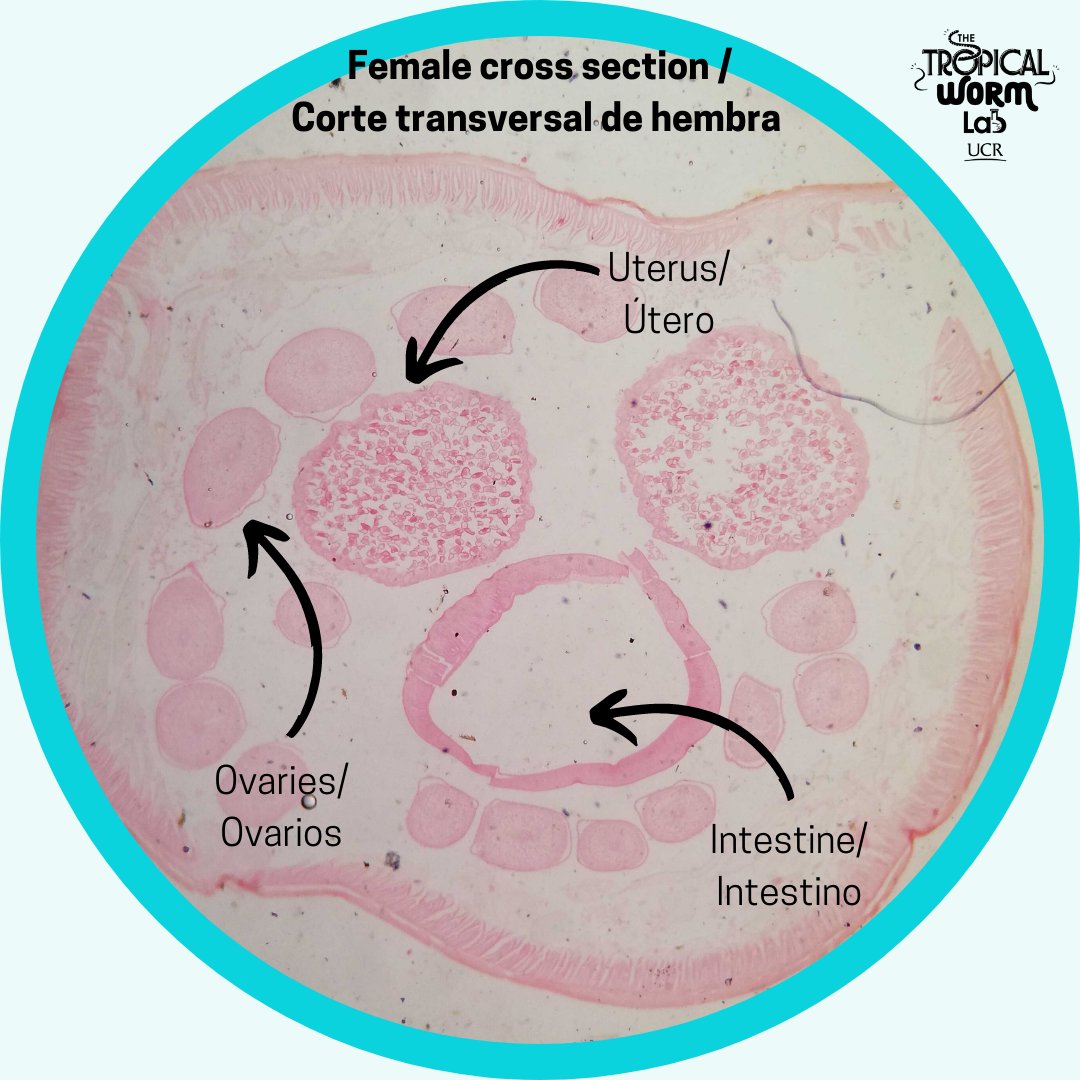 Ascaris Lumbricoides Cross Section